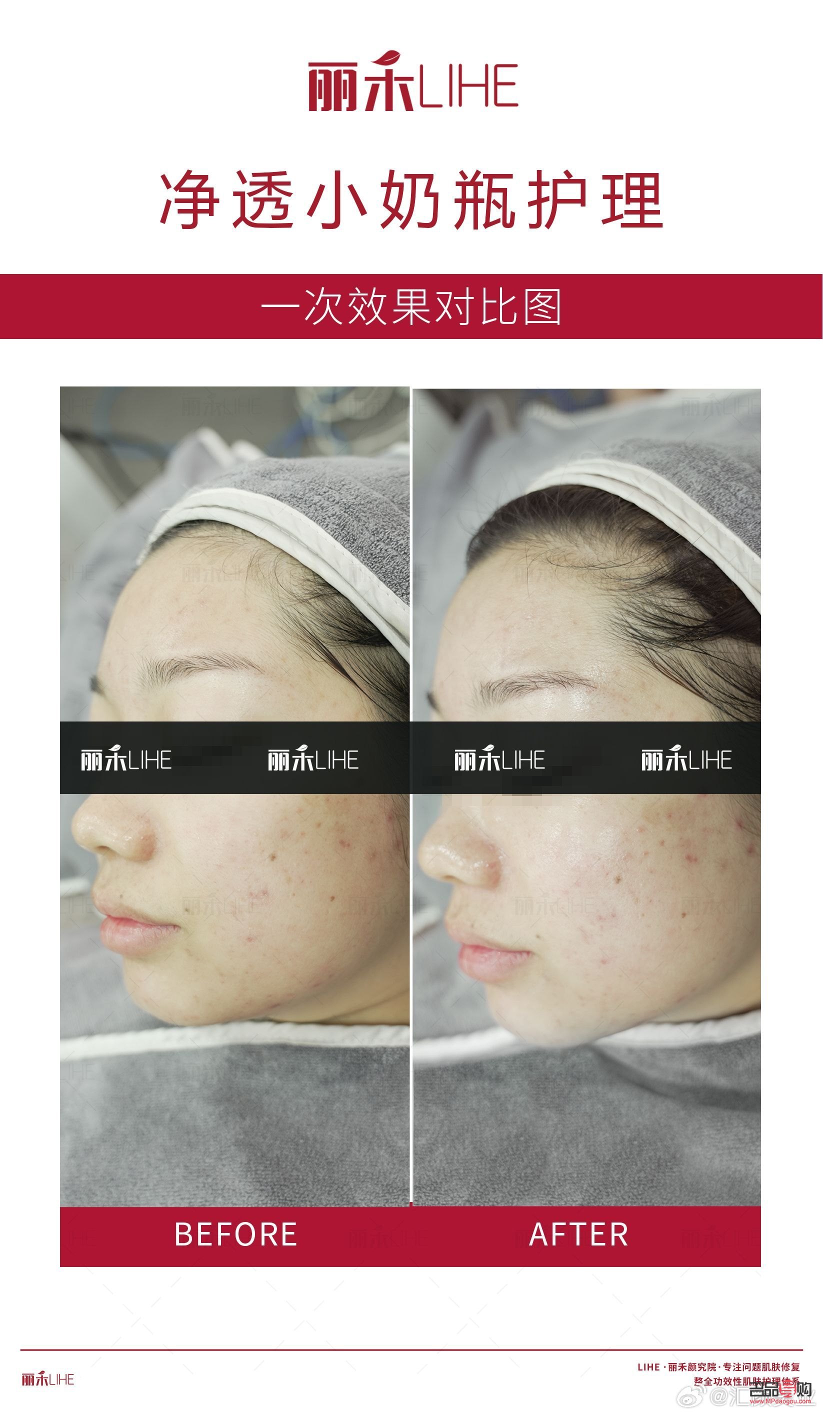 <h3>哪個(gè)美容院祛斑好？專業(yè)祛斑，重拾肌膚光彩</h3>