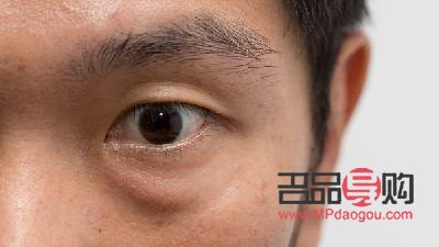 男士去眼袋黑眼圈用什么(男士去眼袋黑眼圈用什么產(chǎn)品效果比較好)