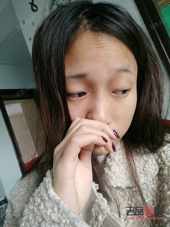 <h3>打了除皺針眼皮下垂能恢復嘛</h3>