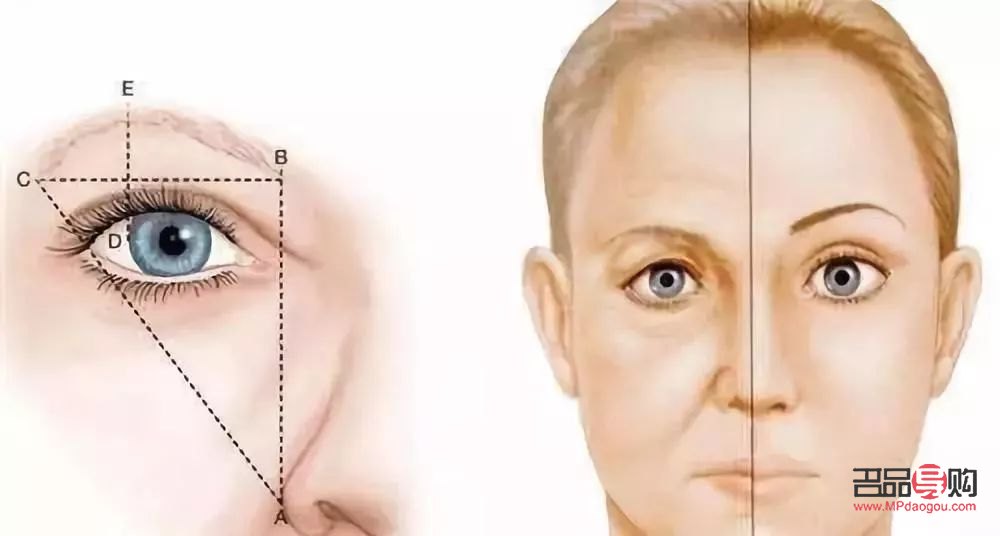 <h3>雙眼皮提眉與割雙眼皮：哪種更適合你？</h3>
