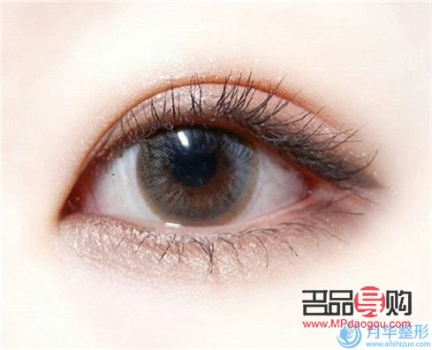 開眼角哪家美名(哪家做開眼角好啊)