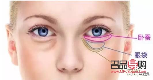 臥蠶與眼袋的區(qū)別詳解