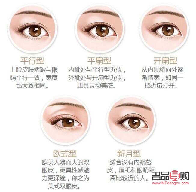 <h3>肉條雙眼皮是什么樣子？詳解雙眼皮類(lèi)型與特征</h3>