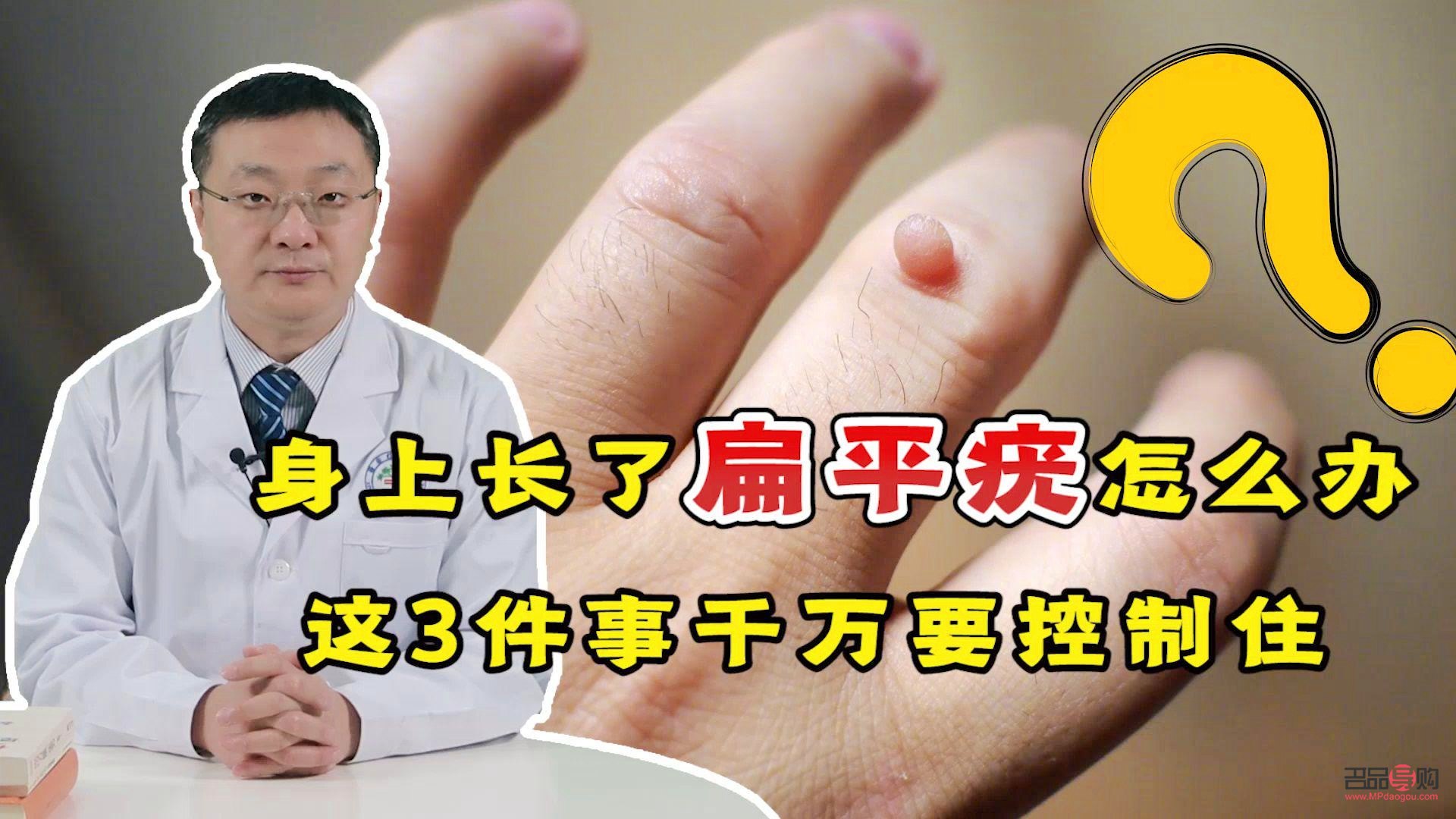 長疣怎么身體護(hù)理(長疣怎么身體護(hù)理最好)