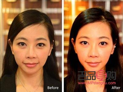 如何改善大小眼除了整形(有什么方法可以改善大小眼)