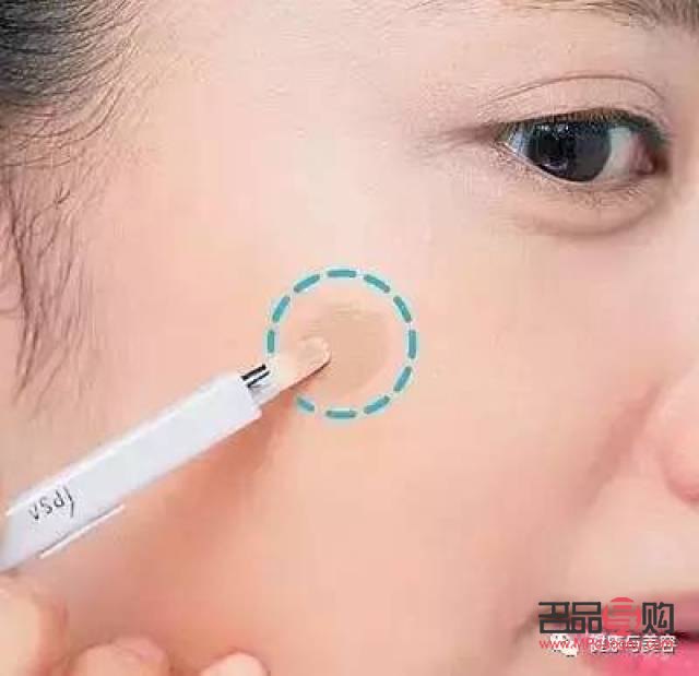 <h3>黑眼圈問題深度解析與醫(yī)生咨詢建議</h3>