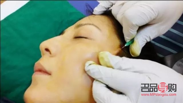 線雕美容好嗎：解析線雕美容的優(yōu)劣與選擇