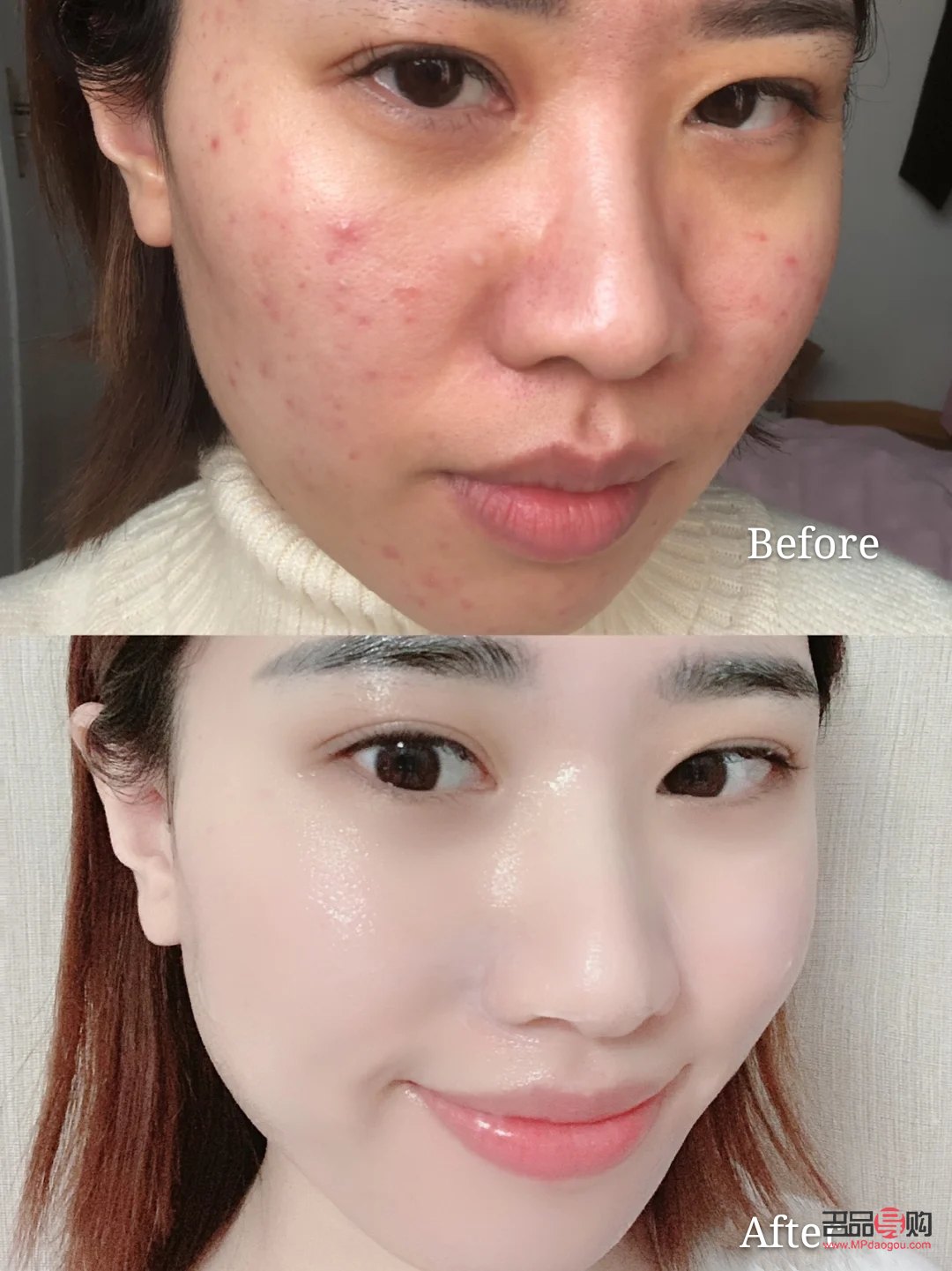 學(xué)美容手要疼多久(學(xué)美容手要疼多久才不疼)