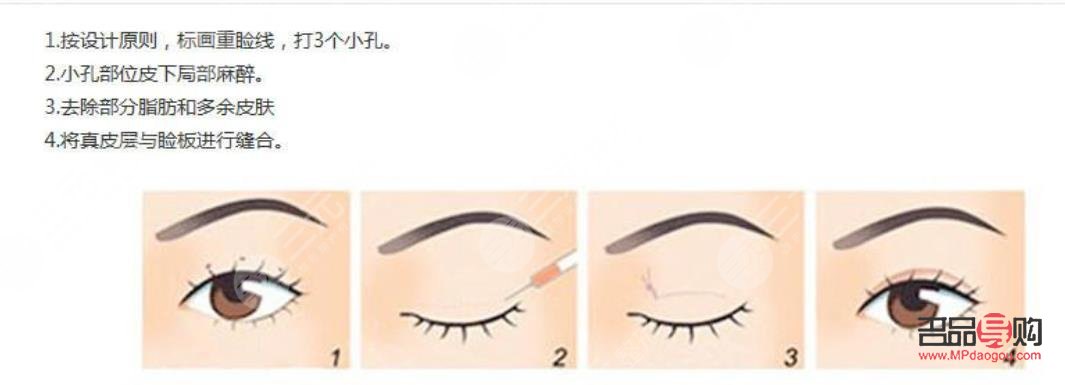 定點(diǎn)雙眼皮視頻全過(guò)程(定點(diǎn)雙眼皮視頻全過(guò)程教程)