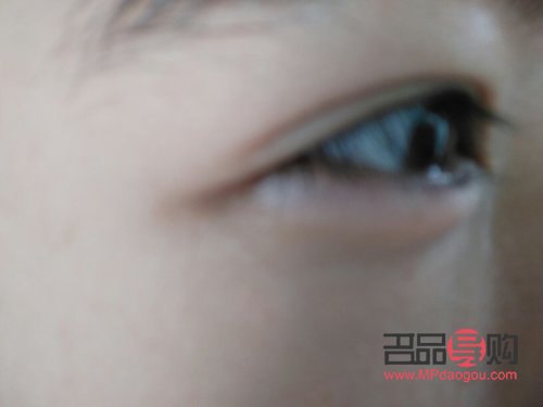 眼袋腫了是什么原因(眼袋腫了是什么原因還有點疼)