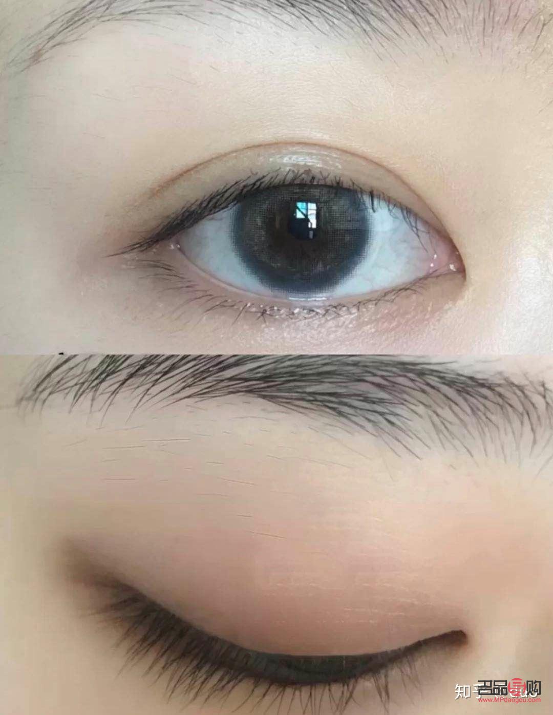 做雙眼皮眼綜合大概多少錢(做雙眼皮眼綜合大概多少錢一次)