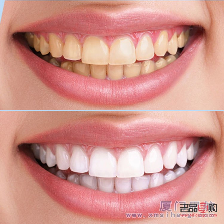 牙齒美容怎么辦