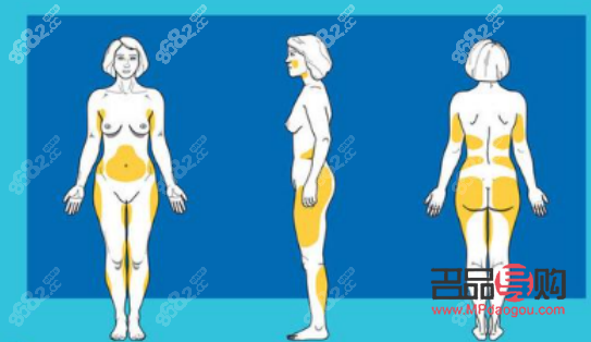 做了抽脂如何護(hù)理身體(做了抽脂如何護(hù)理身體好)