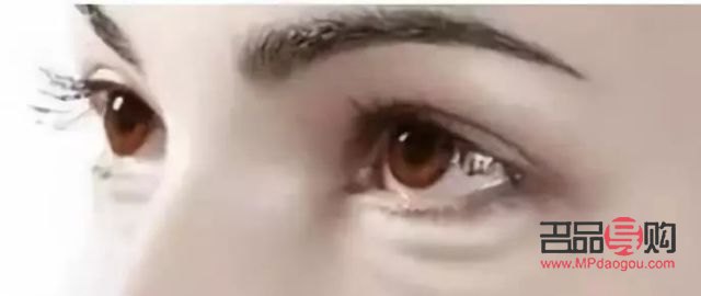 <h3>怎么有效去除黑眼圈眼袋</h3>