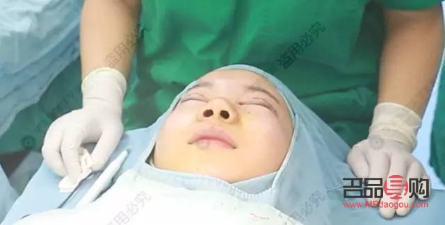 做雙眼皮具備的條件(做雙眼皮具備的條件是什么)