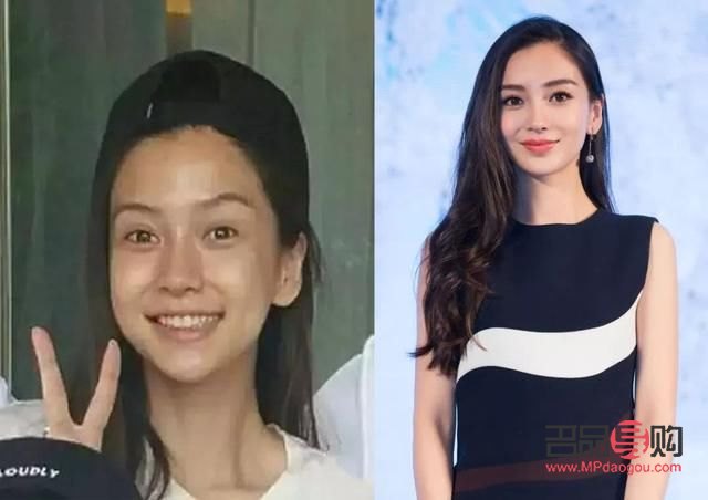 雙眼皮肉條太厚能修復(fù)嗎(雙眼皮肉條太厚能修復(fù)嗎圖片)