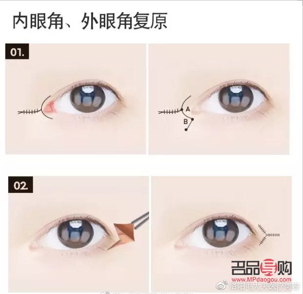 小眼綜合包括哪些項目圖片(小眼綜合包括哪幾項)