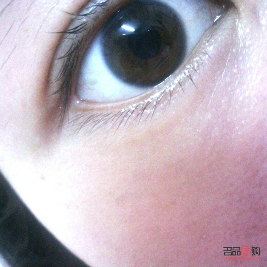 <h3>眼皮有皺紋什么原因</h3>