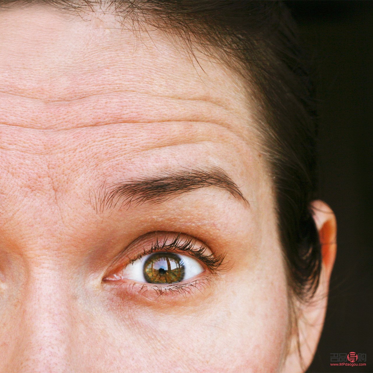 <h3>眼皮有皺紋什么原因</h3>