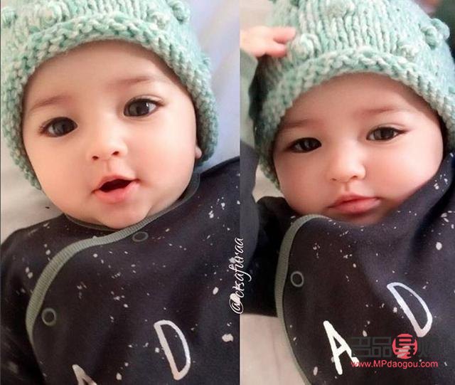 眼皮變松了能自己恢復(fù)嗎？專(zhuān)業(yè)解答與實(shí)用建議