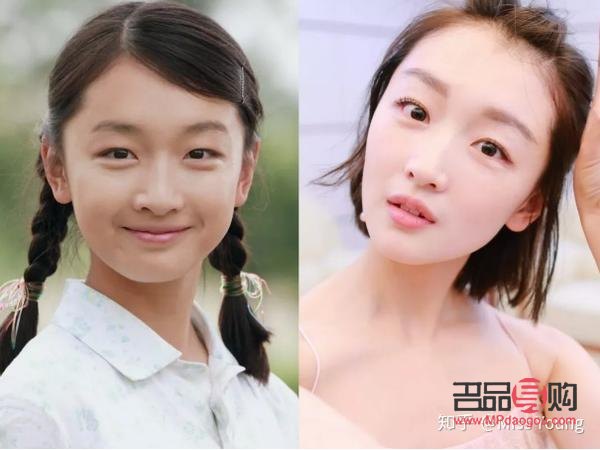 雙眼皮跟內(nèi)雙的區(qū)別(怎么慢慢的把內(nèi)雙變外雙)