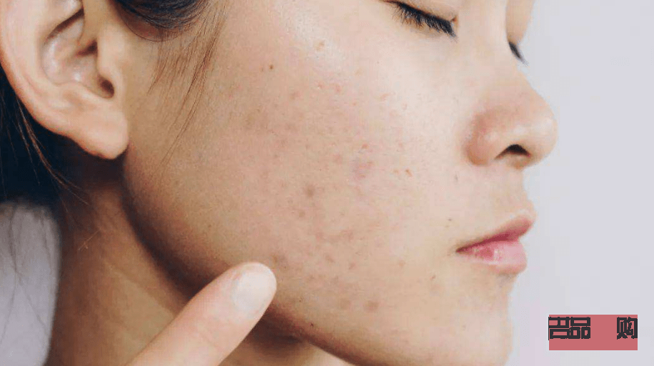 身體過敏護(hù)理油哪種好(身體過敏護(hù)理油哪種好用)