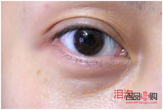 怎么樣保養(yǎng)眼睛不產(chǎn)生眼袋和淚溝(怎么樣保養(yǎng)眼睛不產(chǎn)生眼袋和淚溝的方法)