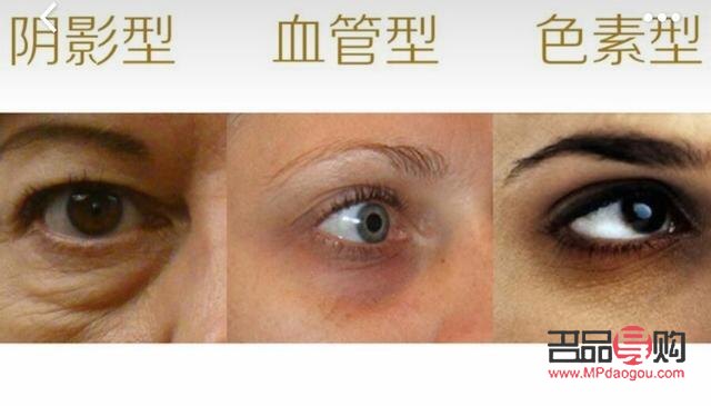 怎么樣保養(yǎng)眼睛不產(chǎn)生眼袋和淚溝(怎么樣保養(yǎng)眼睛不產(chǎn)生眼袋和淚溝的方法)