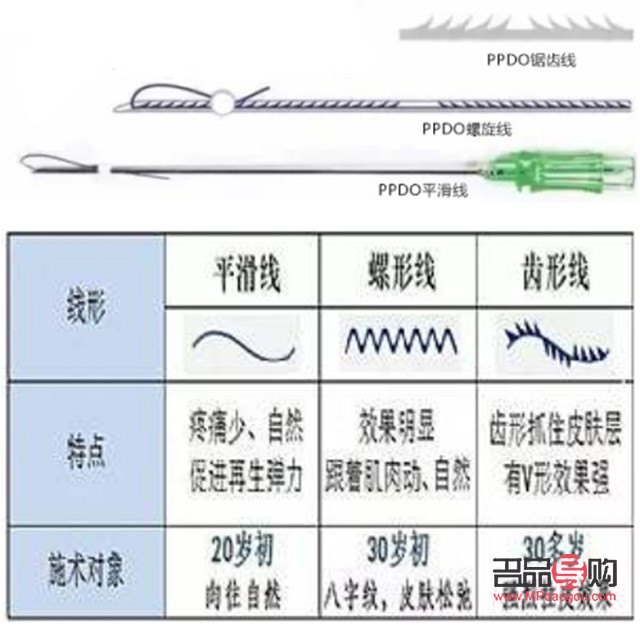 美容線分什么型號(美容線分什么型號好)