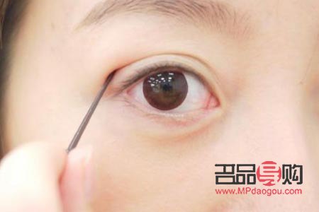 割雙眼皮手術(shù)多久恢復(fù)(割雙眼皮手術(shù)多久恢復(fù)正常)