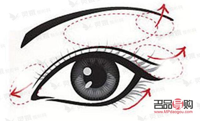 雙眼皮扇形和平扇的區(qū)別圖片(雙眼皮扇形和平扇的區(qū)別圖片對比)