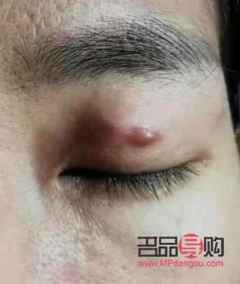 男生有必要去割雙眼皮嗎(男生有必要去割雙眼皮嗎圖片)