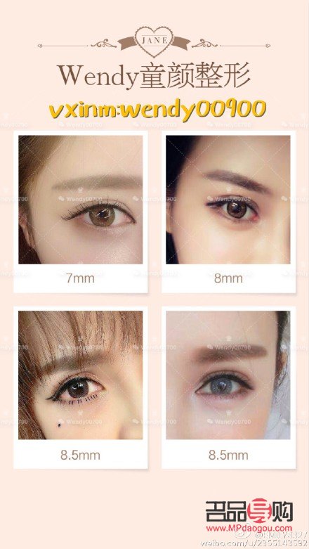 雙眼皮7mm恢復(fù)后多寬圖片女(雙眼皮7mm恢復(fù)后多寬圖片女生)