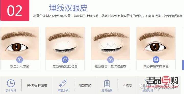 無痕跡雙眼皮與埋線雙眼皮的區(qū)別詳解