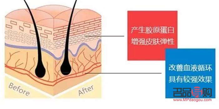 美容面部線雕：塑造青春輪廓的秘籍