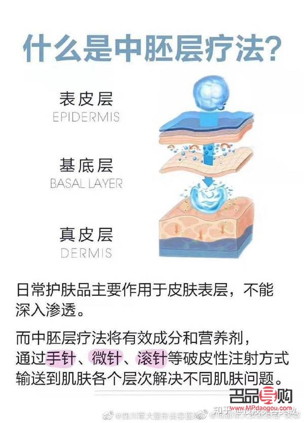 什么是中胚美容(什么是中胚美容有副作用嗎)