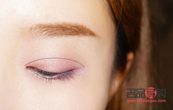 <h3>割雙眼皮有褶皺圖片大全圖解</h3>