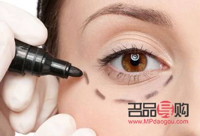 vottov去眼袋怎么樣(vmax去眼袋)