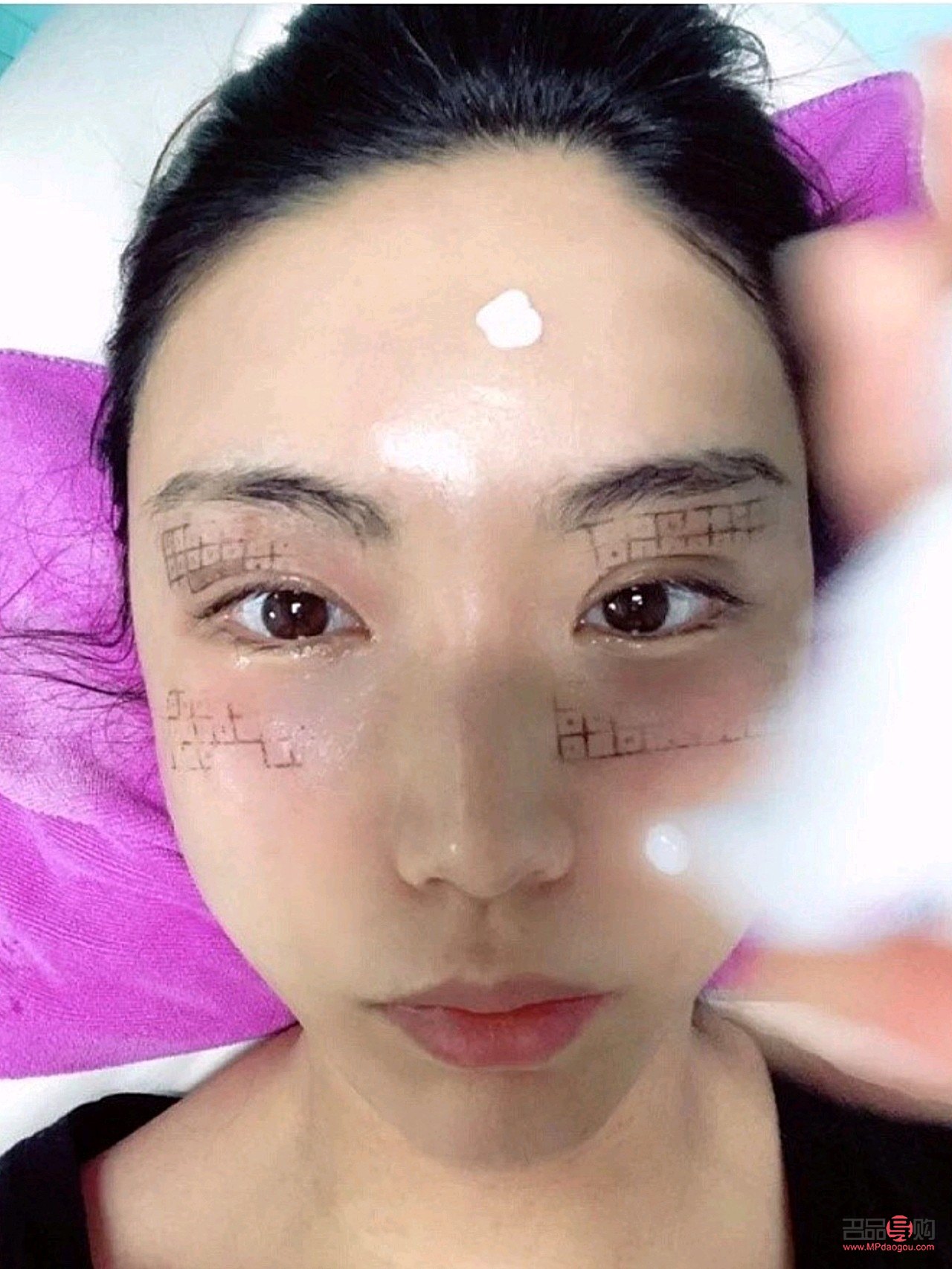 眼部熱瑪吉有恢復(fù)期嗎(眼部熱瑪吉多久恢復(fù))