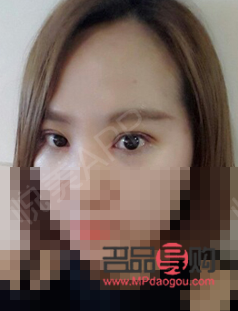 一單一雙的眼皮怎么辦(一單一雙的眼皮怎么辦才好看)