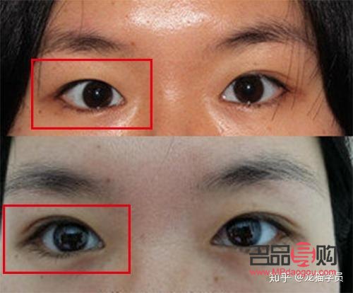 一單一雙的眼皮怎么辦(一單一雙的眼皮怎么辦才好看)