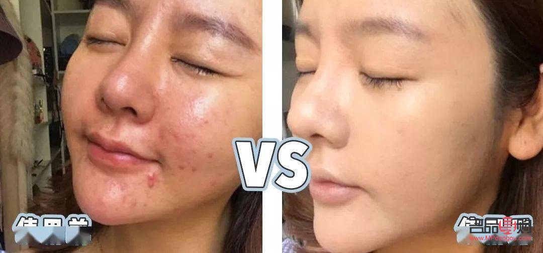 探討未洗臉狀態(tài)下的美容可能性