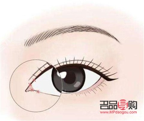 眼綜合一共有多少個(gè)項(xiàng)目(眼綜合一共有多少個(gè)項(xiàng)目可以做)