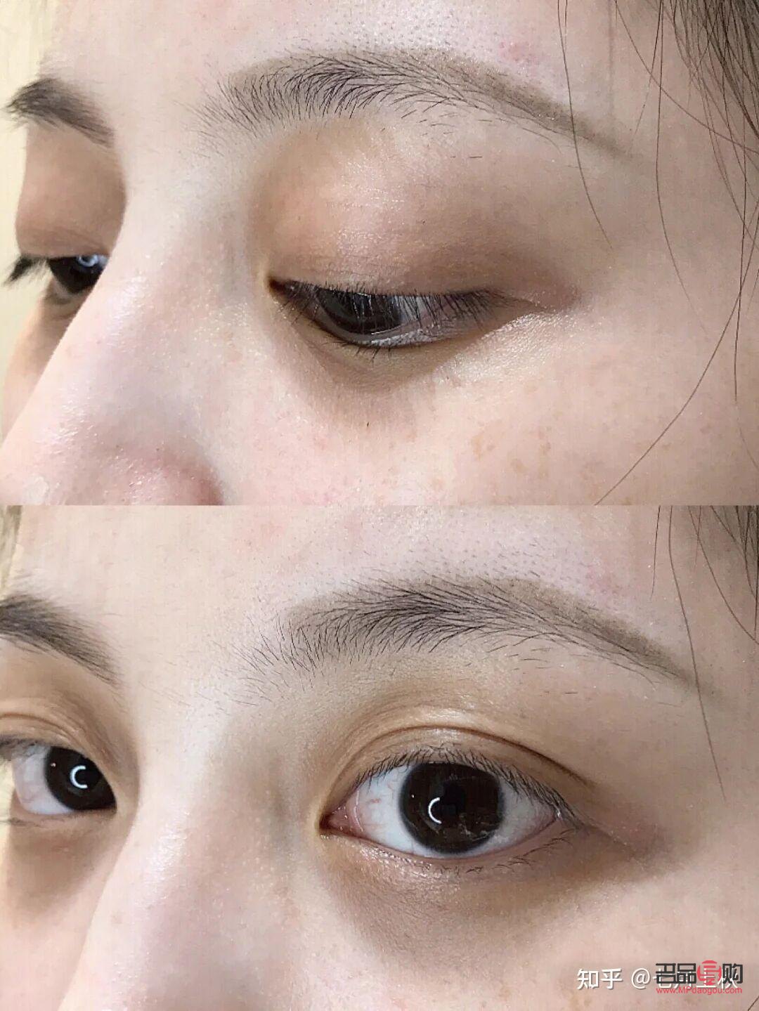 學生怎么去眼袋和黑眼圈(學生怎么去黑眼圈和眼袋的簡單方法)