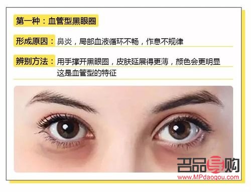 學生怎么去眼袋和黑眼圈(學生怎么去黑眼圈和眼袋的簡單方法)