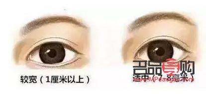 開扇形雙眼皮真人圖片(開扇形雙眼皮的圖片)