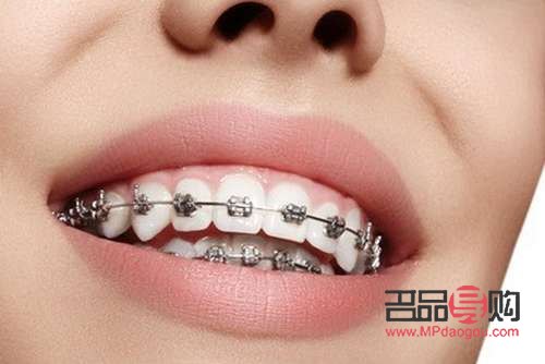 <h3>美容院整牙齒嗎？專業(yè)解答與注意事項</h3>