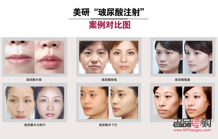 <h3>醫(yī)學美容探秘：打造完美容顏的科學之道</h3>