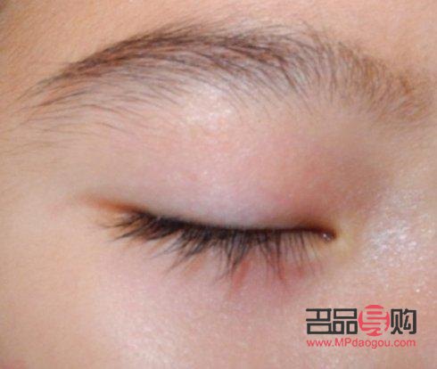 <h3>如何揉出雙眼皮疤痕：專業(yè)指導(dǎo)與注意事項(xiàng)</h3>