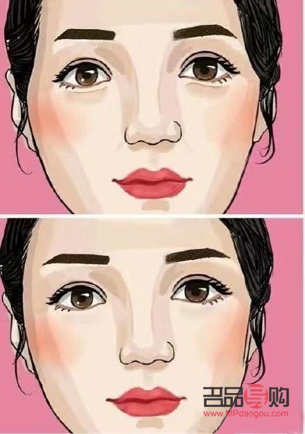 顴骨外擴(kuò)也美容嗎(顴骨外擴(kuò)一定很丑嗎)